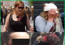 Κρατικές δολοφονικές απόπειρες εναντίον διαδηλωτών traumaties-291x300.jpg